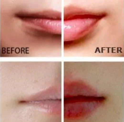 Miracle Lip Plumper 11:11